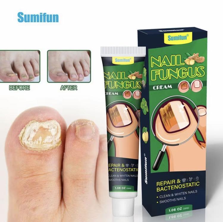 2024 hot sale  Healthy Nail Essence repair gel, nail repair nail care nail art, treatment of nail removal cream fungus infection paronychia Comfort Manicure Nail Polish,Fix broken nails and relieve pain nail fungus healthy nails