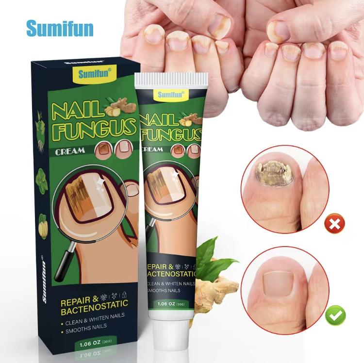 2024 hot sale  Healthy Nail Essence repair gel, nail repair nail care nail art, treatment of nail removal cream fungus infection paronychia Comfort Manicure Nail Polish,Fix broken nails and relieve pain nail fungus healthy nails