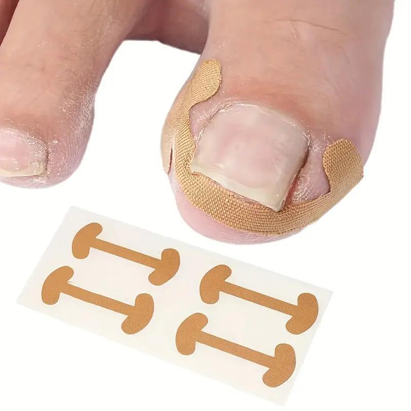 Toenail Correction Patches, 60pcs set Ingrown Nail Correction Sticker, Nail Care Tool for Men & Women, Manicure & Pedicure Tool, Nail Supplies, Christmas Gift