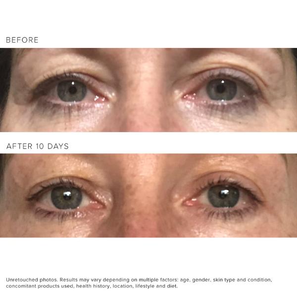 Rodan and Fields Redefine Multi-Function Anti-Aging Eye Cream eye cream retinol eye