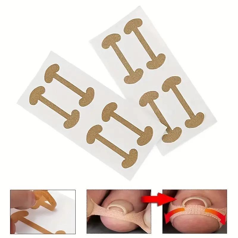 Toenail Correction Patches, 60pcs set Ingrown Nail Correction Sticker, Nail Care Tool for Men & Women, Manicure & Pedicure Tool, Nail Supplies, Christmas Gift