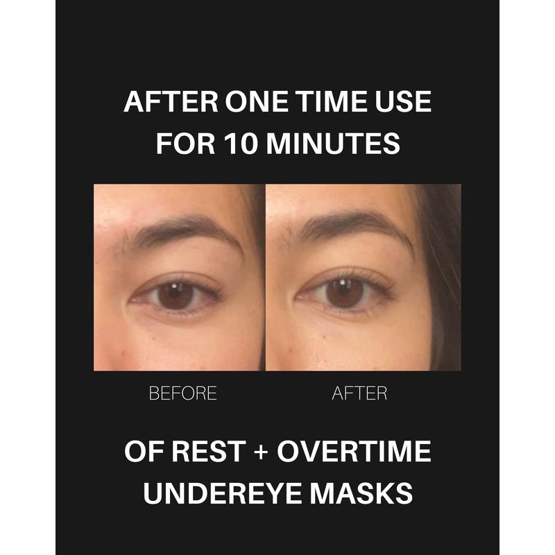 Overtime Undereye Masks