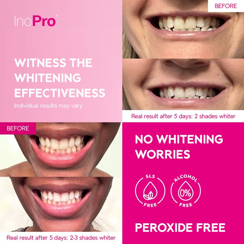 InoPro Teeth Whitening Strips 14 Treatments Kit, Peroxide Free Gentle Enamel Safe Green Strips, Instant Teeth Brightener w  Coconut Oil (28 Strips)