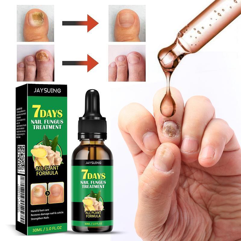 Ginger Nail Treatment Nail Support Nail Care Healthcare Nail Growth Oil For Strength and Moisture, Multi-Purpose Nail Repair, Nail Solution for Discolored and Damaged Nails, 1.0fl oz  Nail polish  JAYSUING 7 days