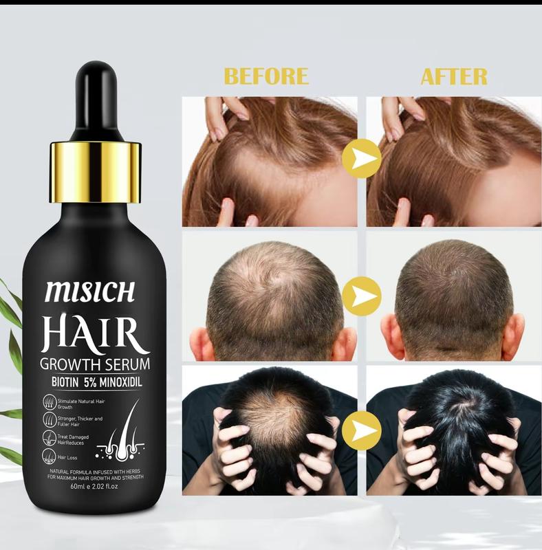 5% Minoxidil Hair Serum(60ml) for Men and Women With Hair Roller Set beard growth oil