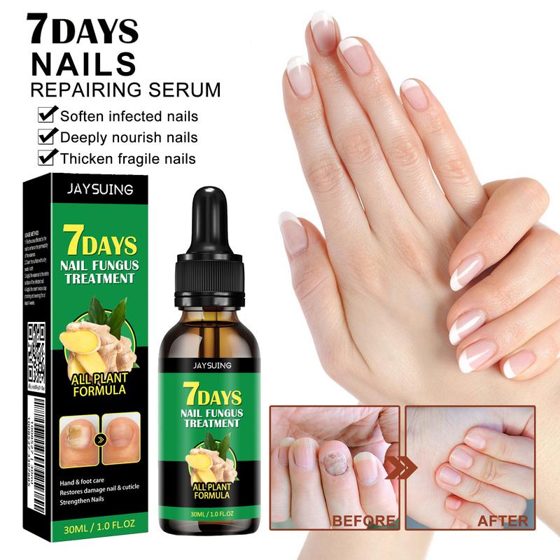 Ginger Nail Treatment Nail Care Healthcare Nail Repair Support Drop Nail Health Care Solution with Ginger extract Nail Growth Oil For Strength and Moisture Hongo Free Nail polish Comfort Moisturizer