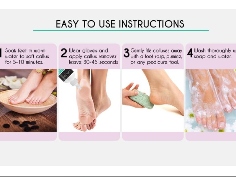 Professional Best Callus Remover Gel for Feet and Foot Pumice Stone Scrubber Kit Remove Hard Skins Heels and Tough Callouses from feet Quickly and Effortless 4 oz (1 Bottle)