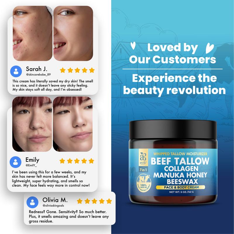 All-in-One Whipped Beef Tallow for Skin (5 oz.) - Arctic Beauty Face & Body Moisturizer Cream for All Skin Types - 100% Grass-Fed & Made of Natural Ingredients