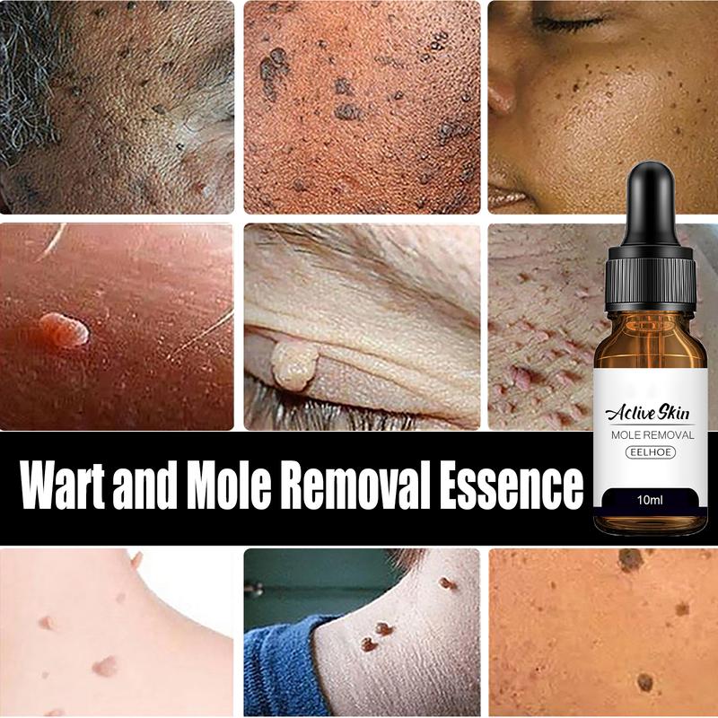 EELHOE Spot Moles And Warts Essence, Skin Meat Granule Removal Repair Cleansing Treatment Essence