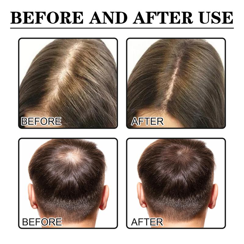 Hair Growth Serum Oil Biotin Hair Regrowth Treatment for Scalp Hair Loss Hair Thinning for Men Women