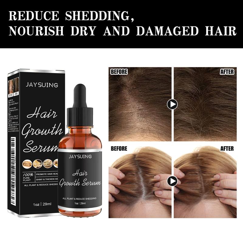 Hair Growth Serum Oil Biotin Hair Regrowth Treatment for Scalp Hair Loss Hair Thinning for Men Women