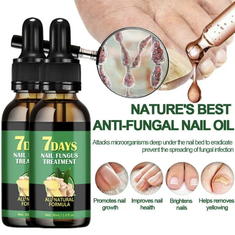 JAYSUING Ginger Nail Treatment|Vitamin E & Plant Essential Oils for Nail Care| Supports Recovery from Onychomycosis, Paronychia, & Nail Deformation | Comforting Manicure & Nail Art Solution Ginger Nail Nourishing Smooth