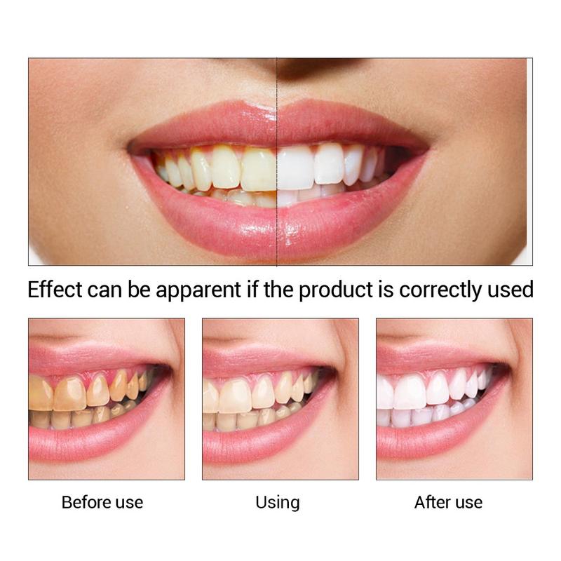 LANBENA Teeth Whitening Essence Powder Oral Hygiene Cleaning Serum Removes Plaque Stains Tooth Bleaching Dental Tools Cleansing Menthol Cleanser