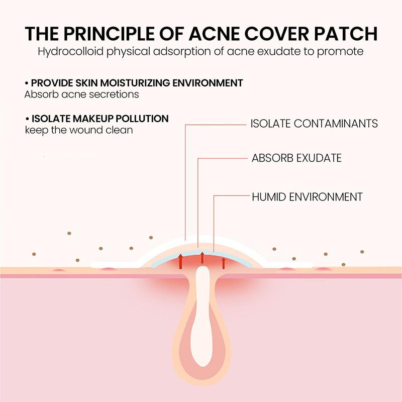 Acne Patches, 200pcs box Professional Acne Patch, Facial Skin Care Product for Women & Men, Daily Skincare Product for Acne Prone Skin