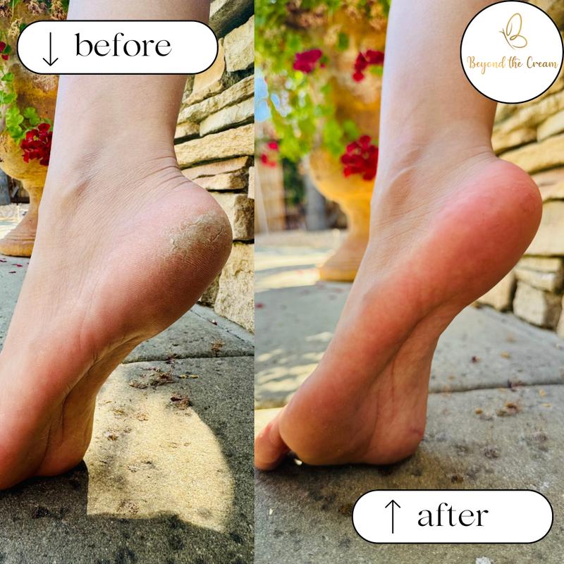 Foot File by Beyond The Cream x The Thai Lyfe. Exfoliates and softens callused and cracked feet. Say hello to baby soft feet! Manicure Nail foot file callus manicure pedicure hard skin