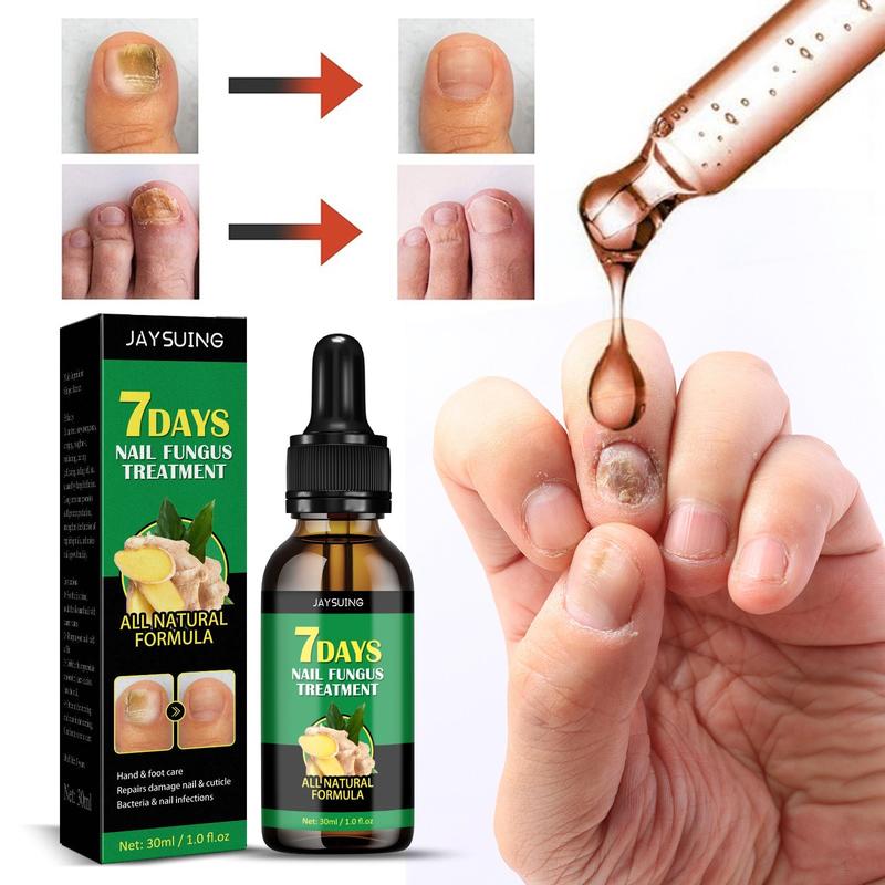 Ginger Nail oil Treatment Multi-Purpose Repair Solution for Discolored and Damaged Nail Care Comfort