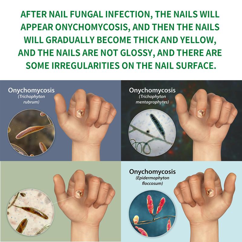 Multi-Purpose Nail Repair, Nail Solution for Discolored and Damaged Nails