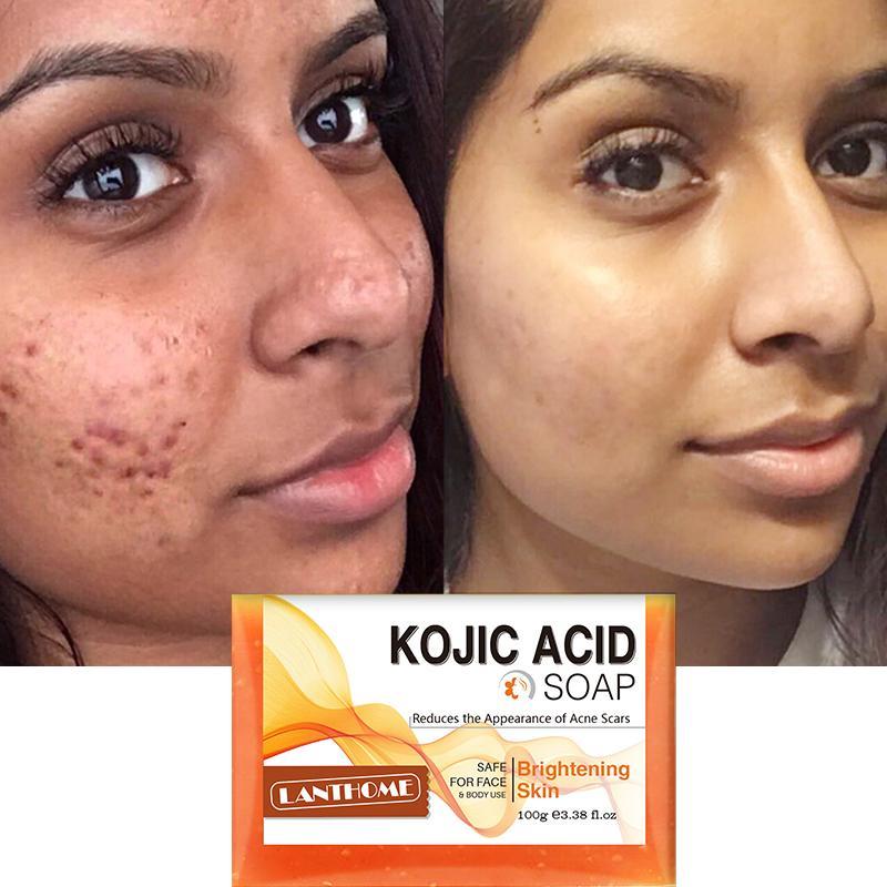 Kojic Acid Facial Soap, Reduce Acne & Scar, Facial Brightening Soap, Skincare Product for Women & Men, Skin Cleansing Soap Bar